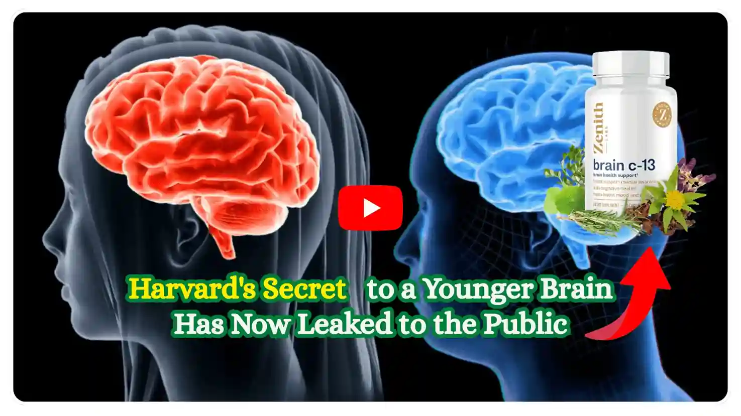 Brain C13 -cognitive function